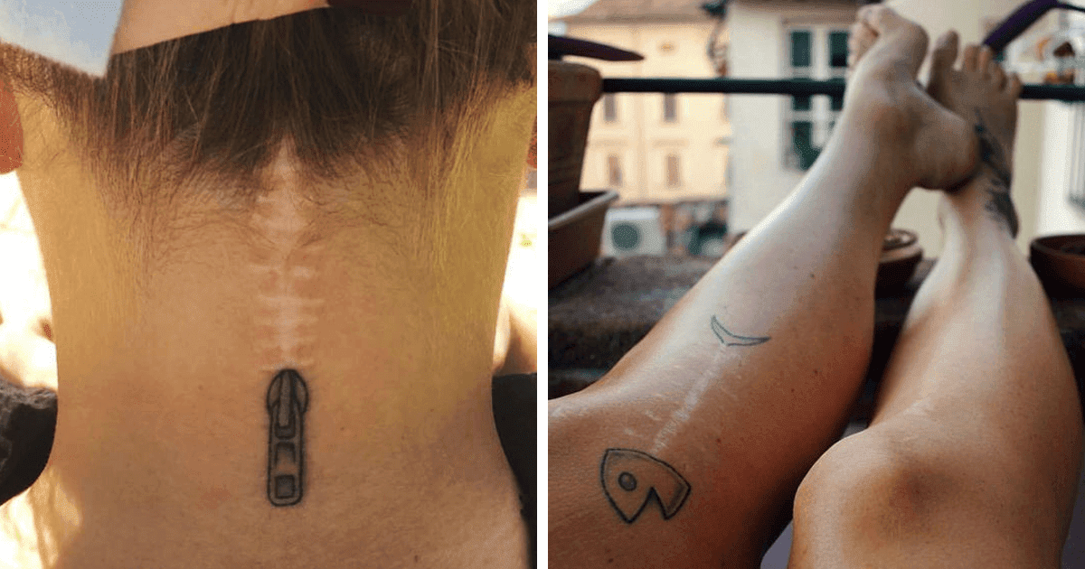 25 Beautiful Tattoos That Transformed Scars Into Artworks